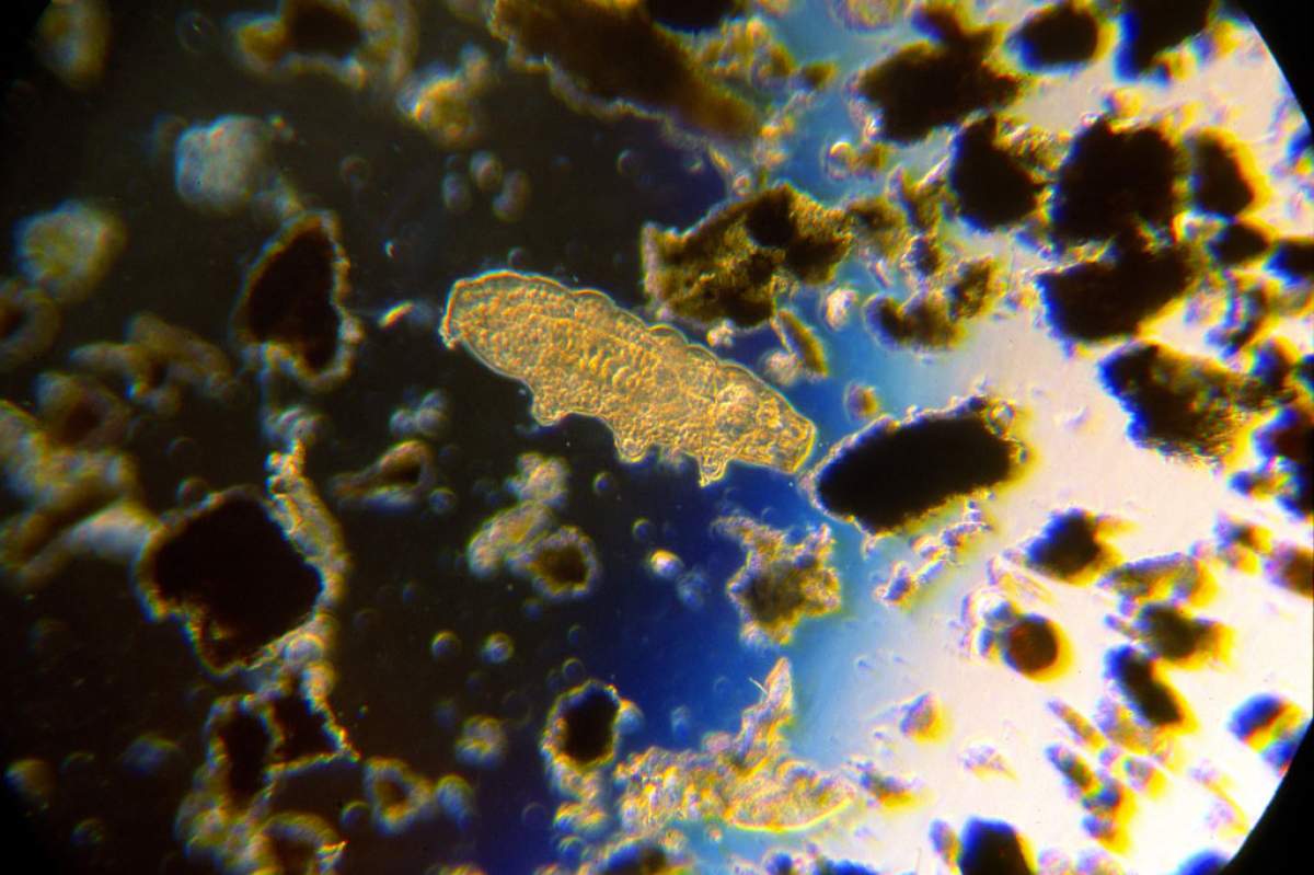tardigrades viewed in a microscope