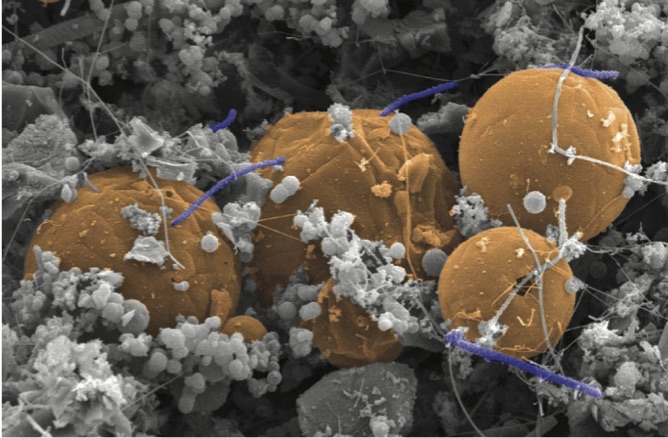 Microbes on a microscopic level