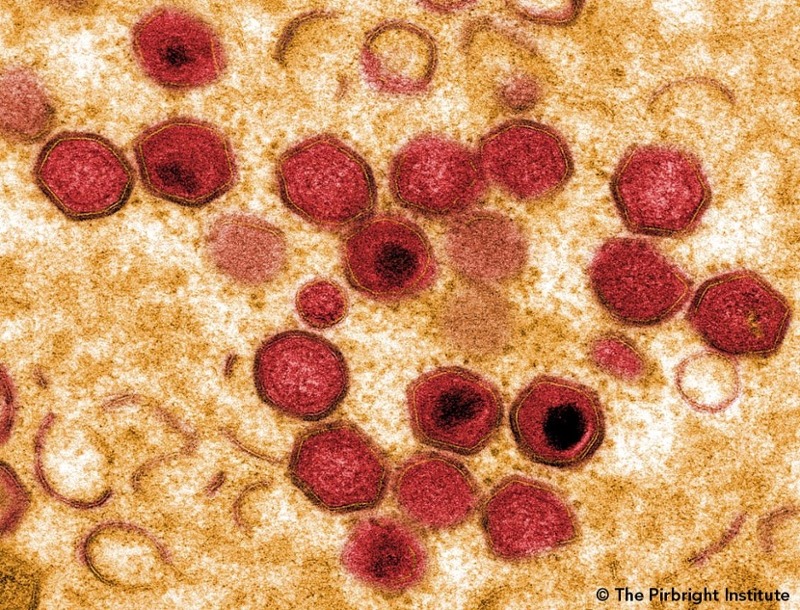 Microscopic view of the virus