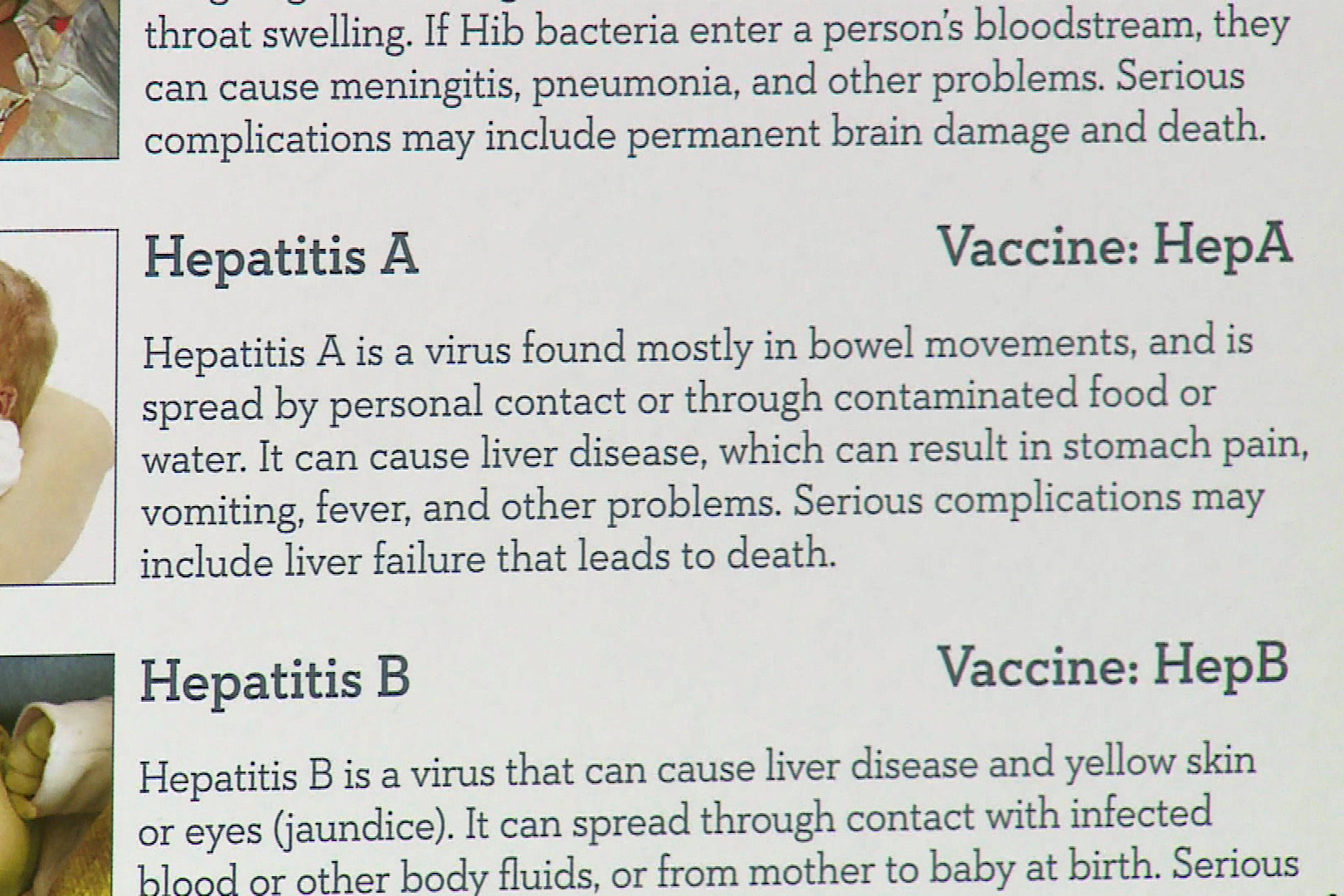 hepatitis b yellow skin