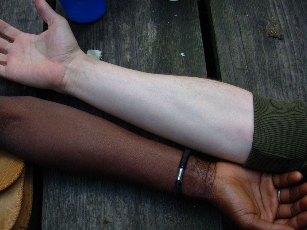Two forearms laying next to each other, one from a white person and one from a black person