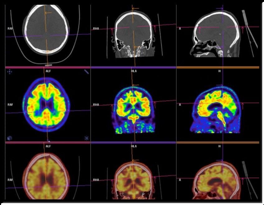 A collection of brain scans in various colors in a grid pattern