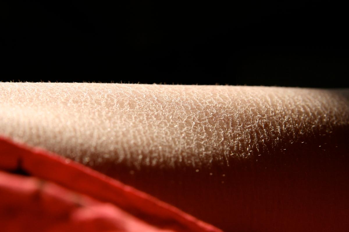 A closeup of an arm with dry skin against a dark background