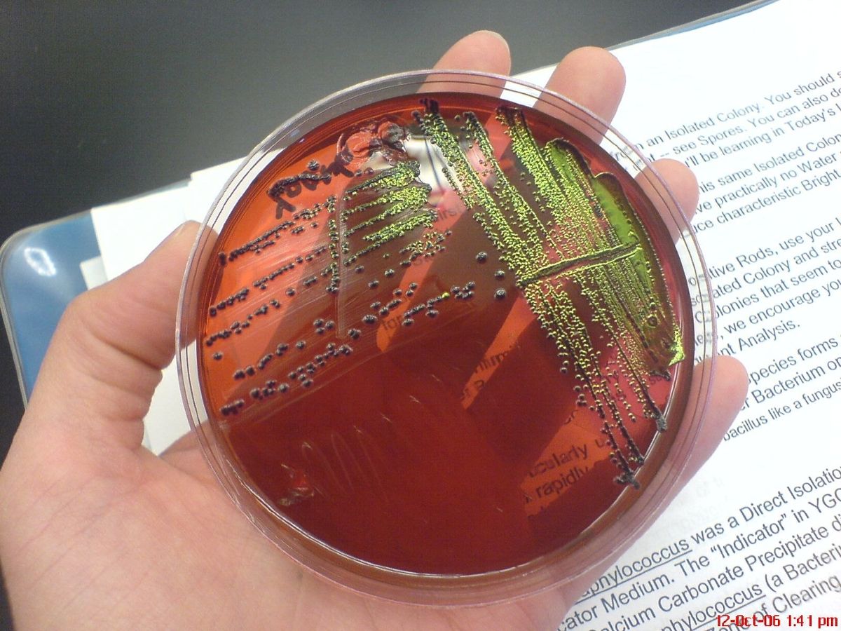 Green e. coli bacteria on a copper-colored sample plate