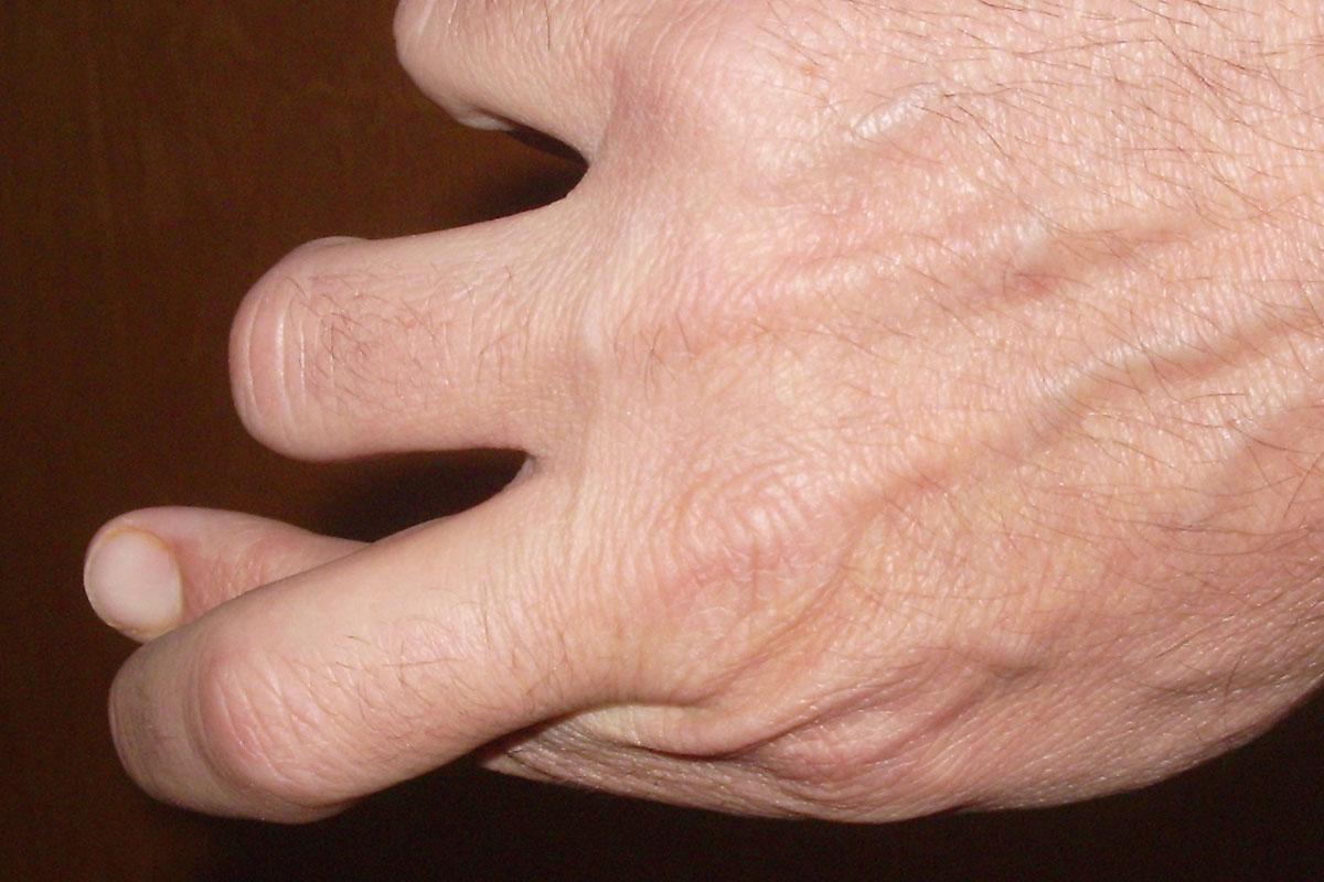 Photo of a hand.