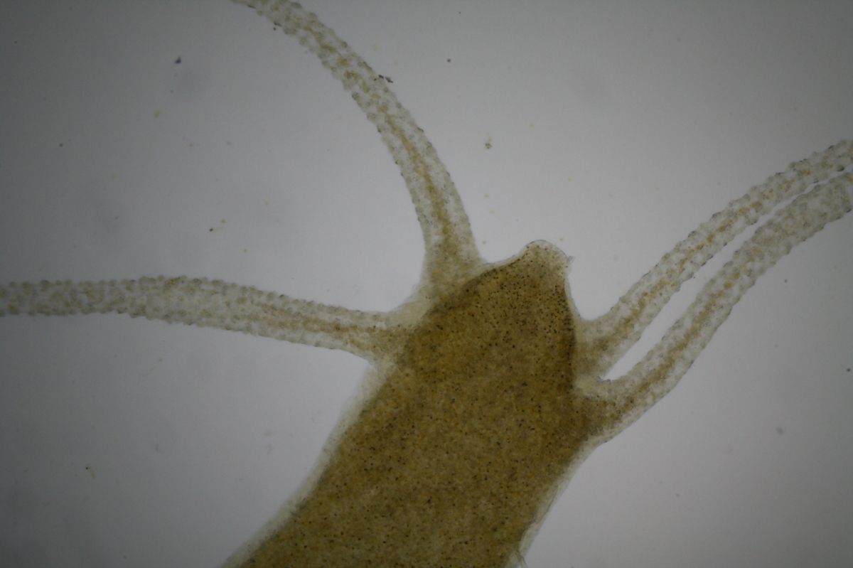 A microscopic hydra with four tentacles and a gritty, sand-like texture visible