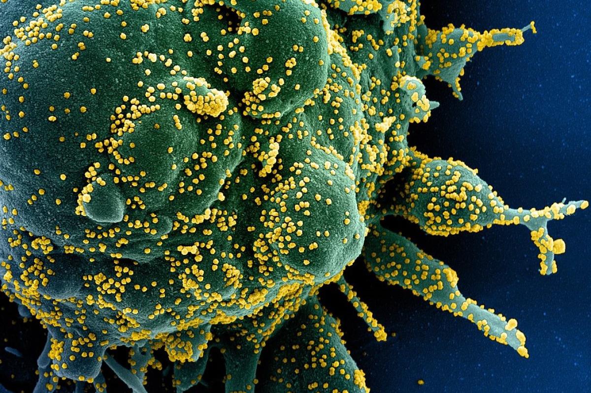 SARS-COV-2 virus closeup