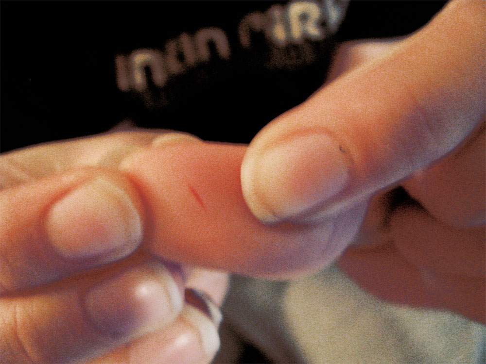 A paper cut on fingertip