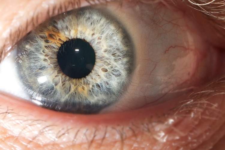 Close up photo of greenish-blue eye