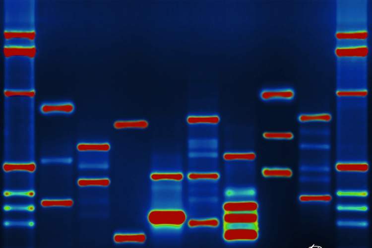A computer-generated representation of an individual's DNA
