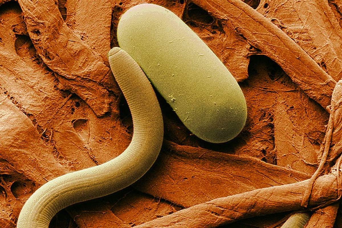 A microscopic worm sits next to a microscopic egg.