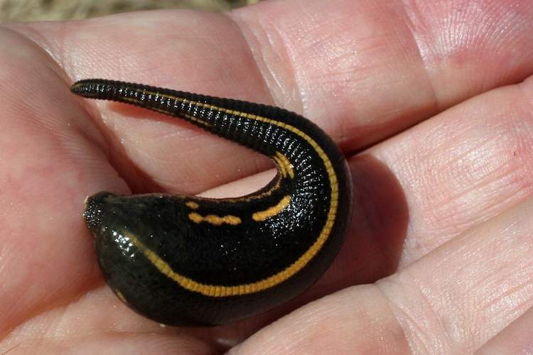 A leech sits on a person's hand