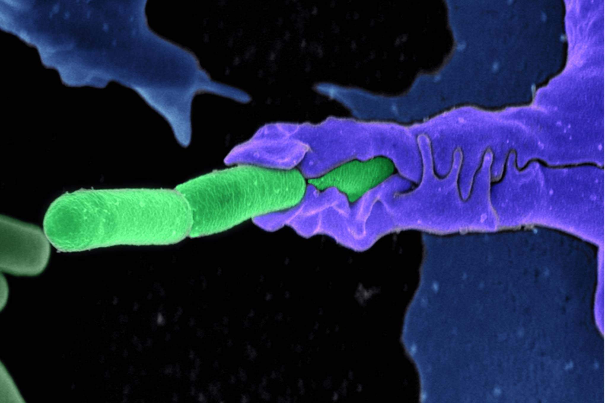 Anthrax bacteria (green) being swallowed by an immune system cell