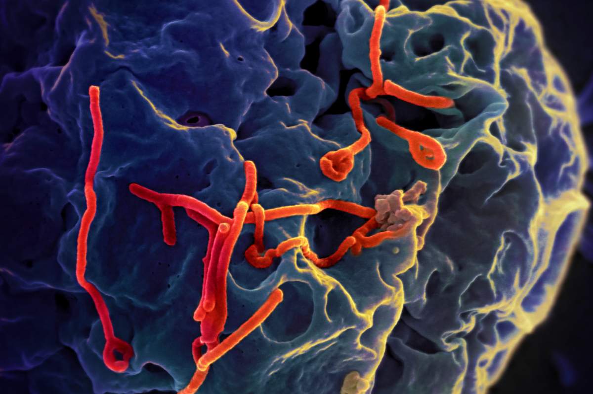 Scanning electron micrograph of Ebola virus budding from the surface of a Vero cell