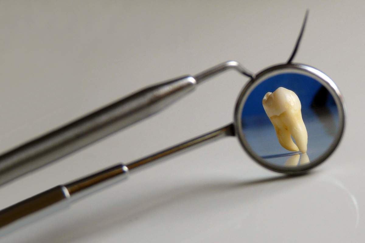 tooth with dental tools