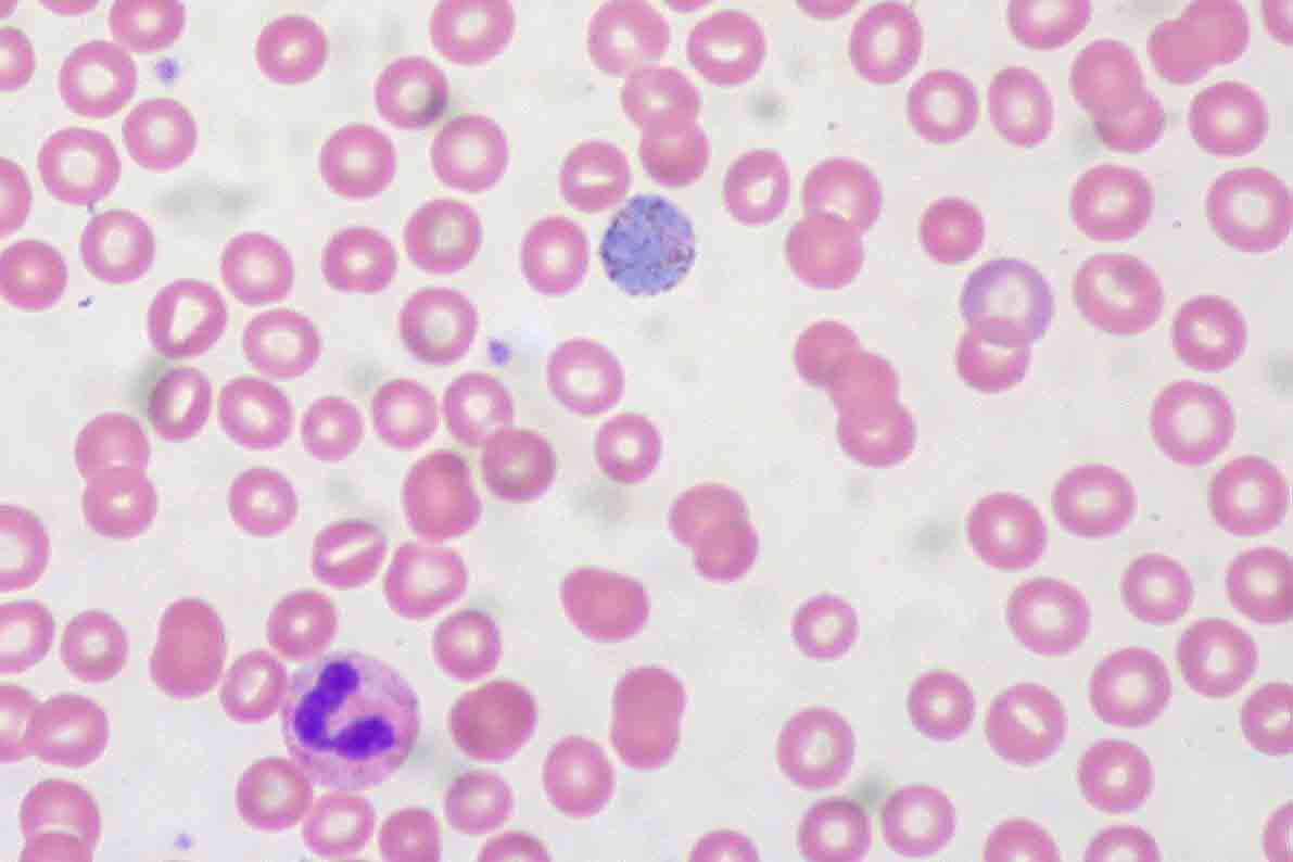 malaria in blood