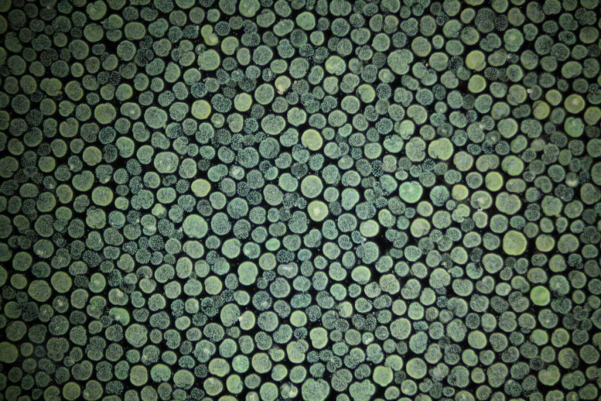 Close up images of blue and green cyanobacteria colonies taken from a lake.