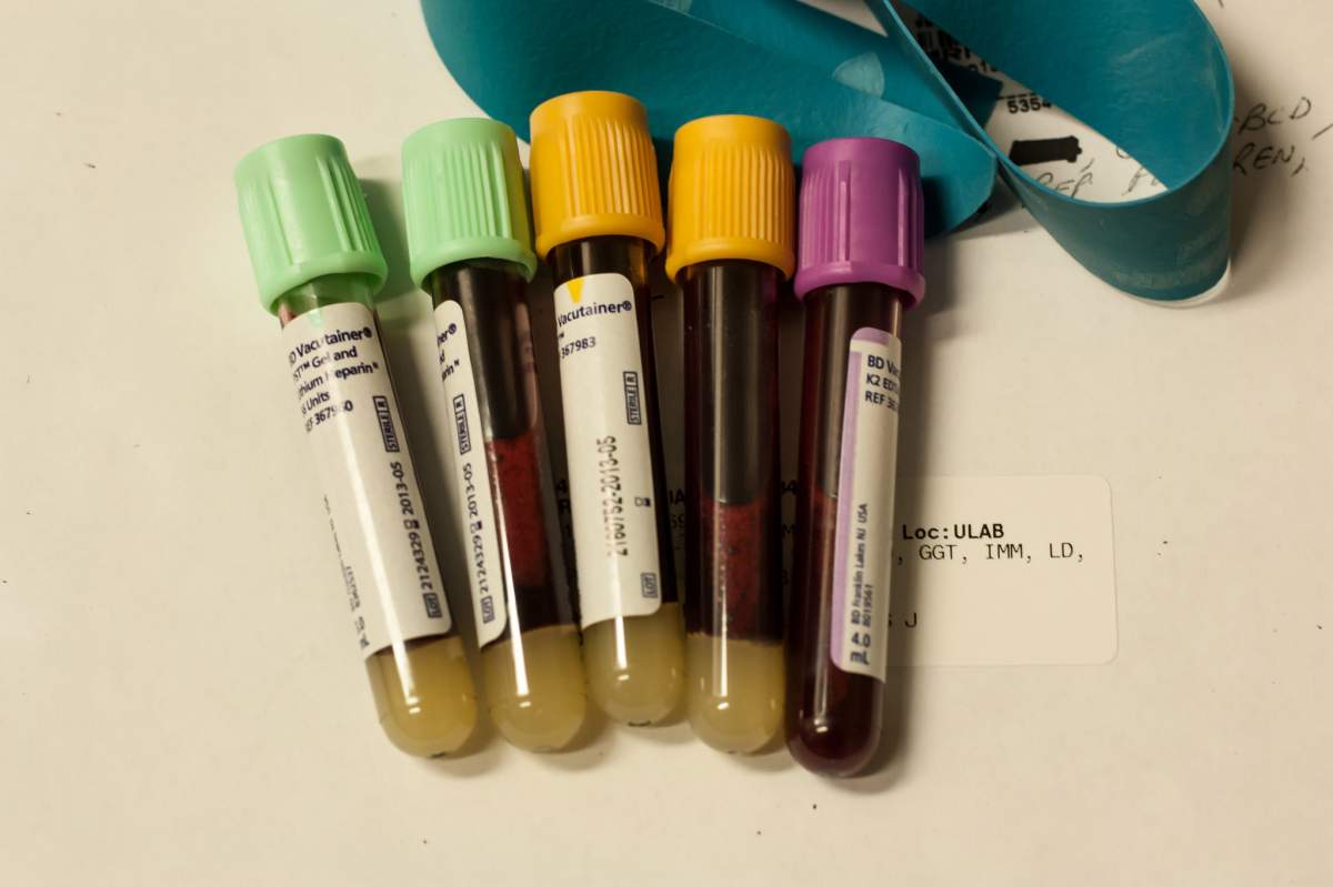 A photo of five capsules filled with blood on a white background.