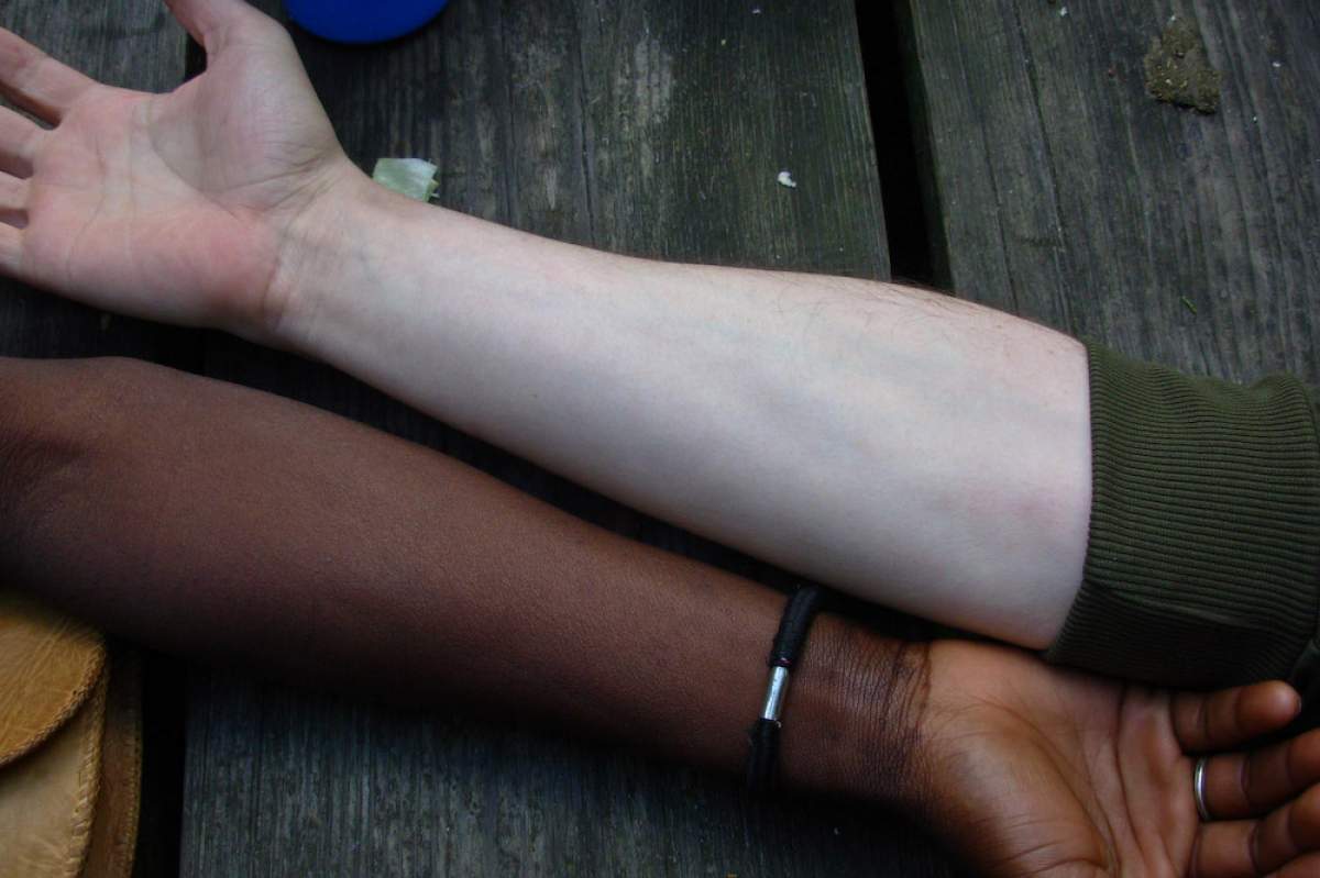 A picture of two people's arms. On the bottom, coming from the left is a person's darker brown arm. On the top is a person's pale peach skin.