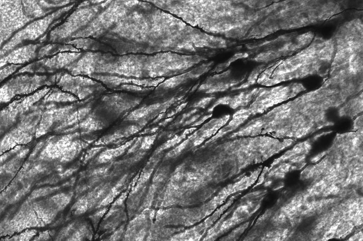 A black and white image via microscope of Golgi stained neurons. The back ground is shades of white and gray, the neurons appears to be black. They resemble tree branches or even a landscape viewed from very far up in the sky.