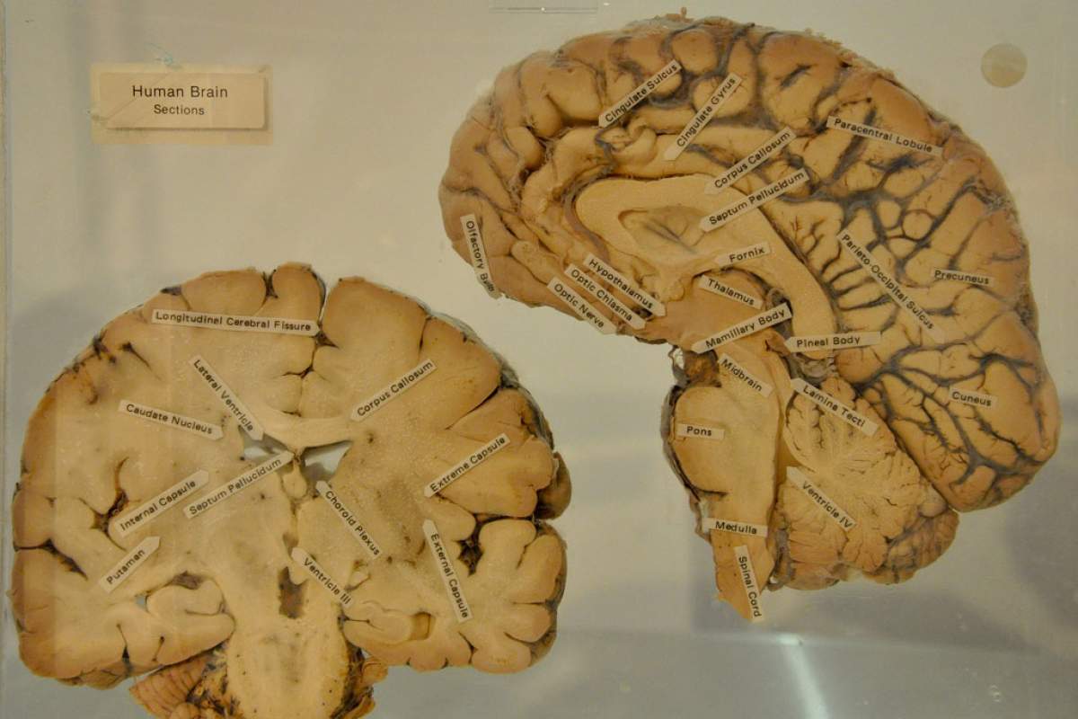 An image of a fake brain cut in half. Each element of the brain is labelled with black text on white paper.