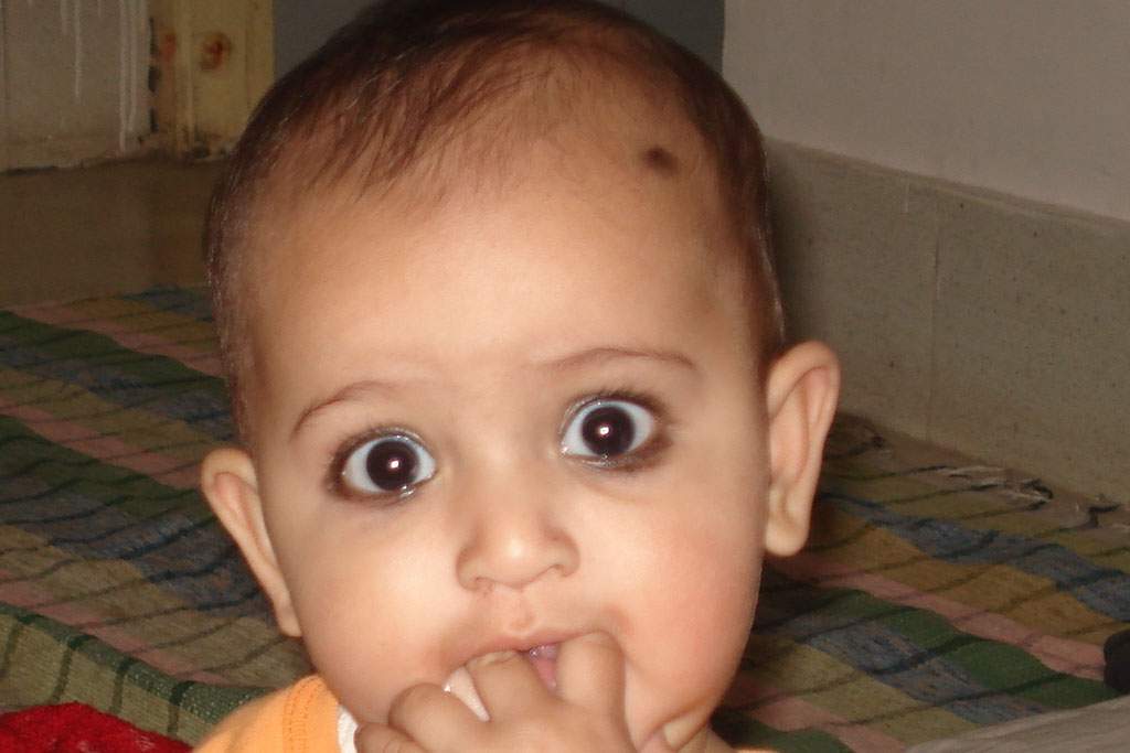 A baby looks into the camera. Some of her fingers are in her mouth. The baby's eyes are dark brown, but there is some red eye visible.