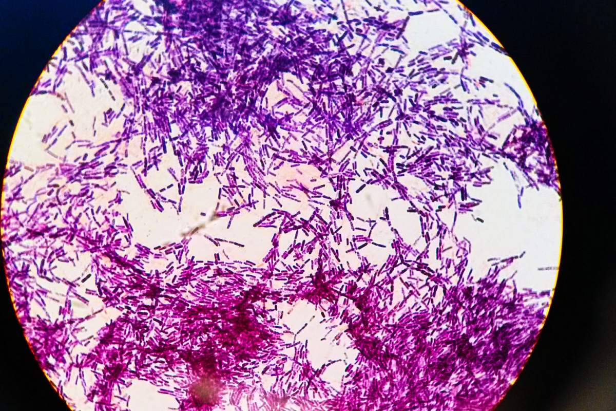 From the image source: "Bacillus thuringiensis (Bt) strain 4A4, as viewed at 1000x magnification after gram staining." (Sam LaRussa, Flickr)