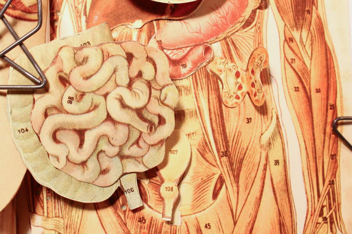 A close-up image of a diagram of a human male digestive system. (lungstruck, Flickr)