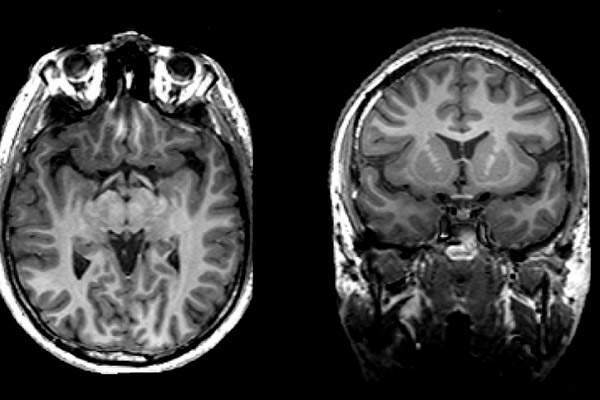 Images of a human brain (Daniele Oberti, Flickr)