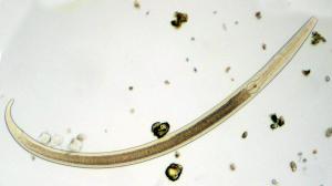 A worm-like nematode under a microscope, very thin and slightly transparent